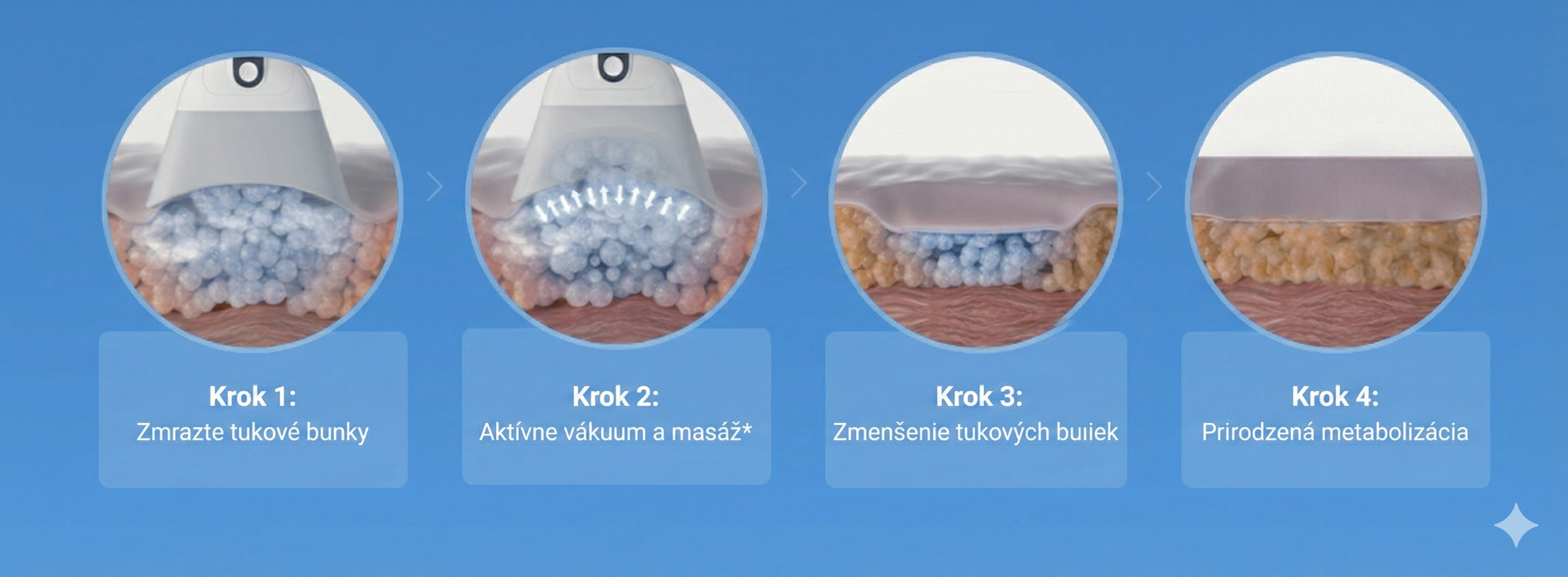 Kryolipolýza - zmrazovanie tukov Bratislava