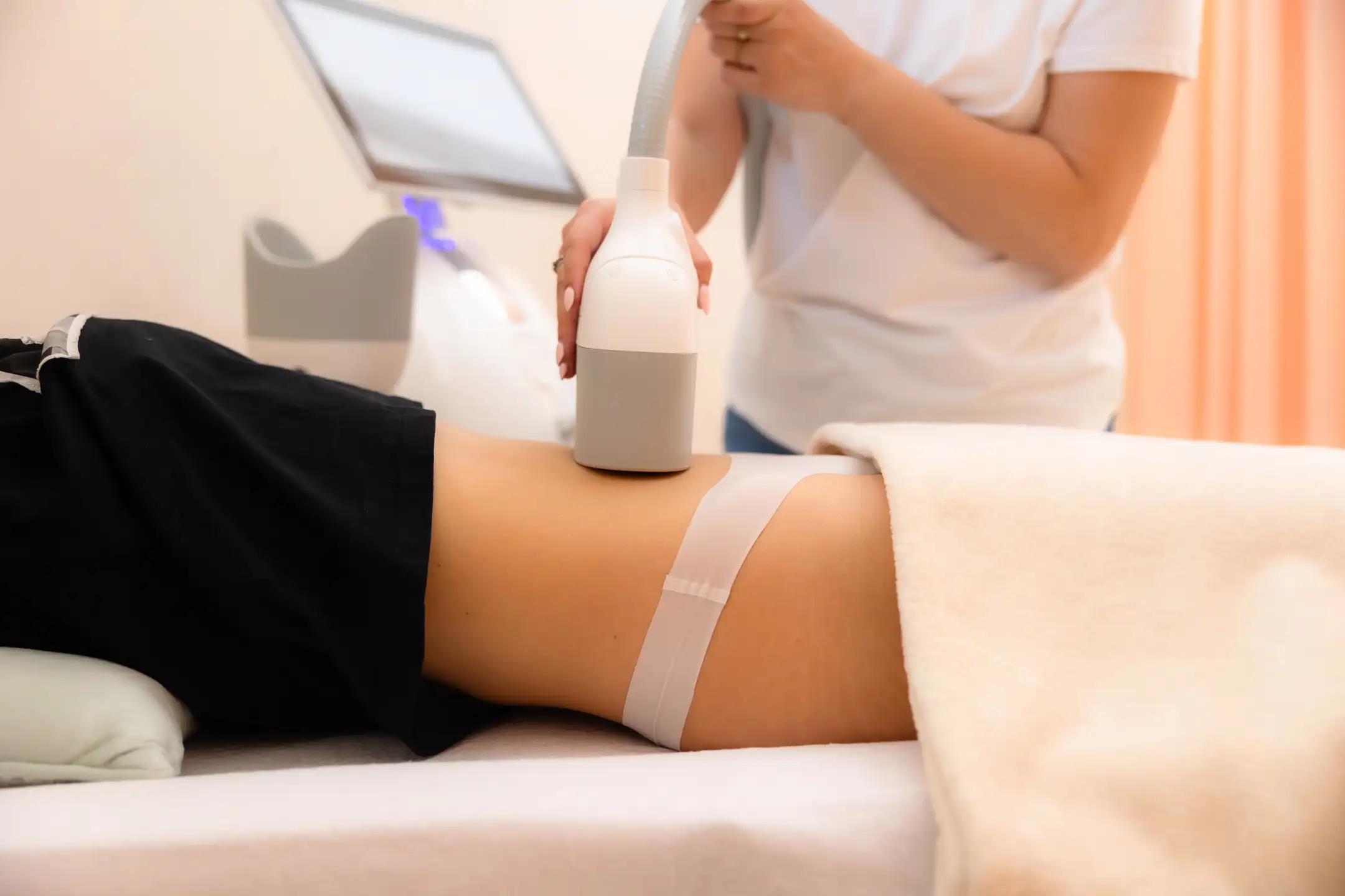 Kryolipolýza ošetrenie brucha