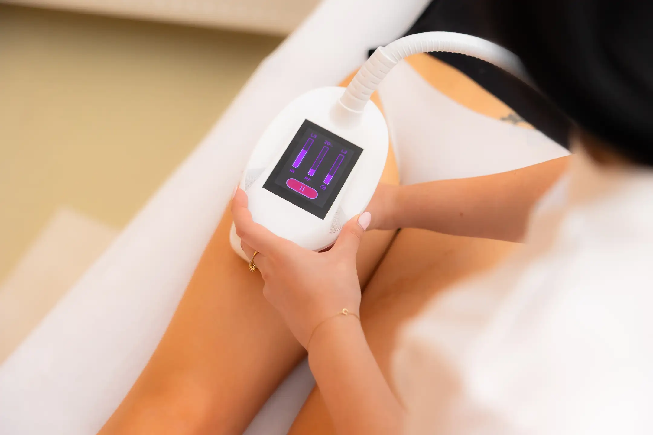 Velashape aplikácia